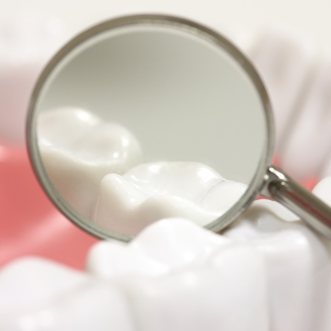 Closeup of smile after dental sealant placement