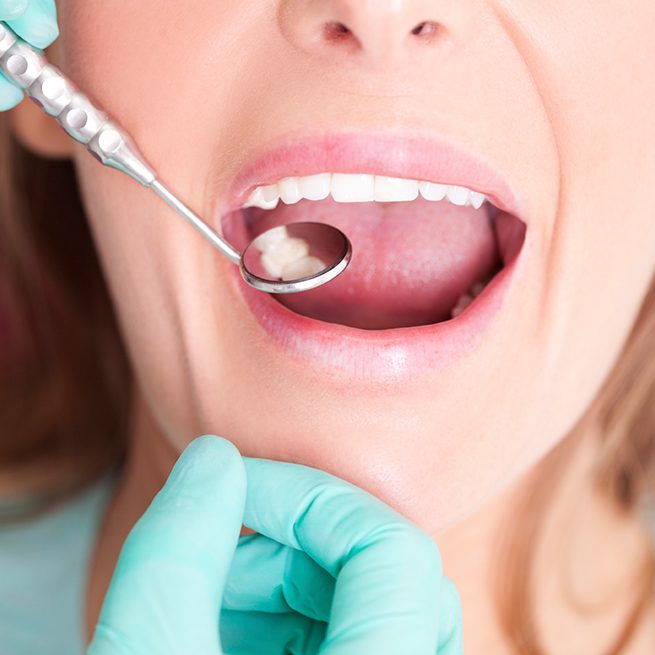 Dentist checking patieent's metal free dental restoration