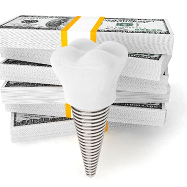 money with a dental implant in Burien