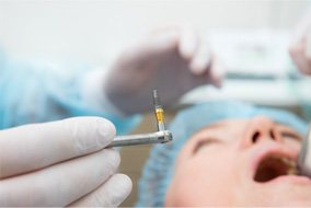 oral surgeon placing dental implants 
